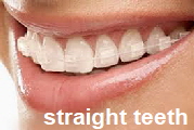 straight teeth