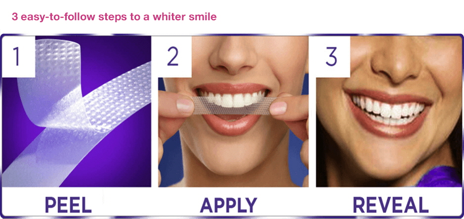 tooth-whitening-white-strips-glasgow-crest